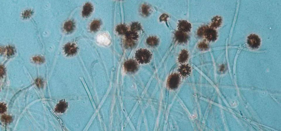 Mold Without Visible Moisture: How Invisible Humidity and Slow Drying Cause Growth